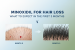 Minoxidil for Hair Loss: What to Expect in the First 3 Months (Tugain Guide)