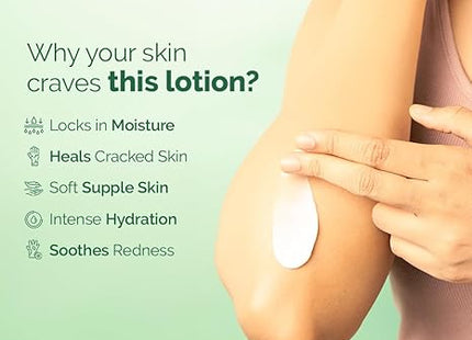 Elovera Lotion Benefits 