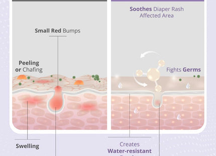 AreoVeda Baby Diaper Rash Cream 25gms