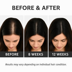 Tryses Pro hair serum 60ml
