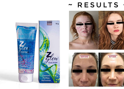 Z Glow facewash for oily & acne prone skin (70 gm)