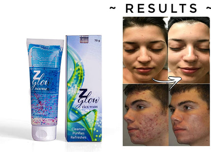 Z Glow facewash for oily & acne prone skin (70 gm)