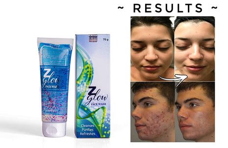 Z Glow facewash for oily & acne prone skin (70 gm)