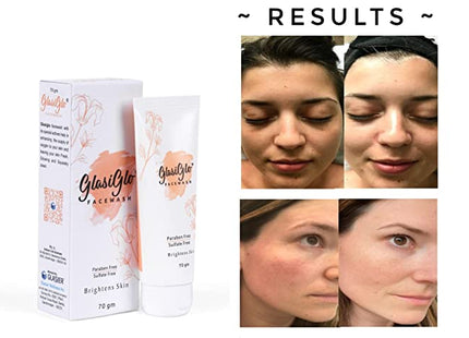 Glasiglo Facewash With Vitamin - C Removes dead skin cells & dark spots ( 70 ml ) (PACK OF 2)