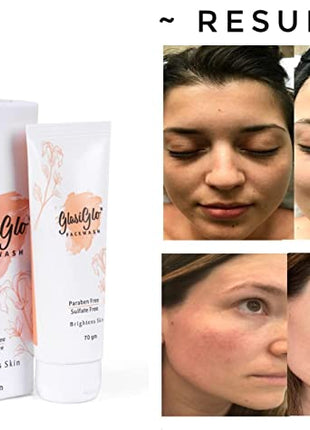 Glasiglo Facewash With Vitamin - C Removes dead skin cells & dark spots ( 70 ml ) (PACK OF 2)