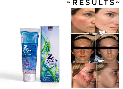 Z Glow facewash for oily & acne prone skin (70 gm)
