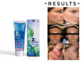 Z Glow facewash for oily & acne prone skin (70 gm) (PACK OF 2)