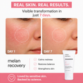 Mesoestetic Melan Recovery 50ML