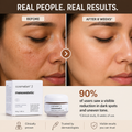 Mesoestetic Cosmelan 2 depigmenting cream product details