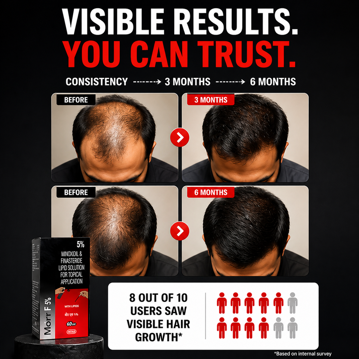 Morr F 5% Hair Solution - Image 4