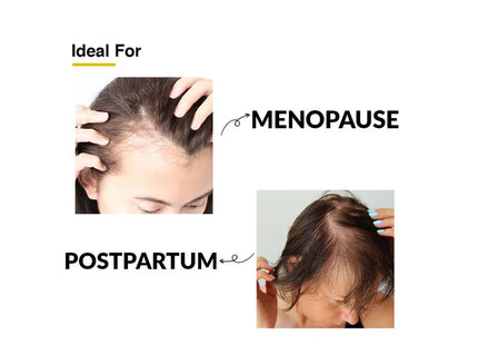 Fixderma Kairfoll Femme Specifique Shampoo 200ml