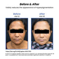 Seekcaus Lumiveil Hyperpigmentation Sunscreen SPF 50 PA++++ | Prevents Hyperpigmentation Recurrence | Blue Light Protection | Alpha Arbutin | Lightweight Fluid Sunscreen | Broad Spectrum UVA UVB Protection | 50ml