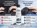 Karissa K TAR Anti-Dandruff Shampoo 200ML