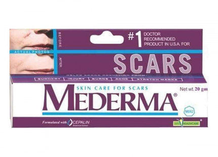 Mederma Skin Care For Scars, 20 gm