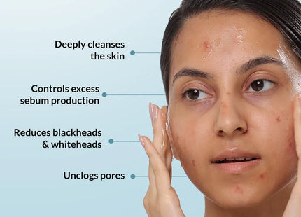 Fixderma Salyzap daily face cleanser for acne 60g